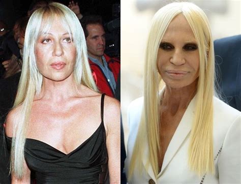 donatella versace plastic surgery|donatella versace facelift.